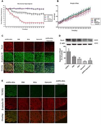 Advanced Oxidative Protein Products Cause Pain Hypersensitivity in Rats by Inducing Dorsal Root Ganglion Neurons Apoptosis via NADPH Oxidase 4/c-Jun N-terminal Kinase Pathways